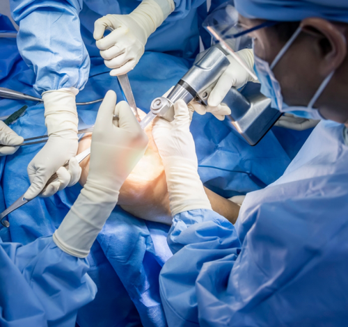 orthopedic-surgen-img1